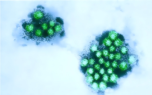 norovirus