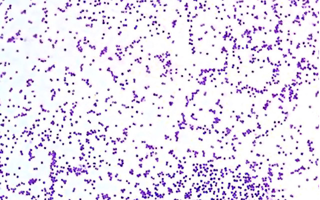 Staphylococcus aureus