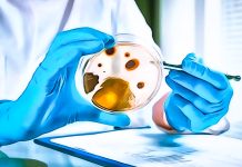 microbiological criteria EU analyses